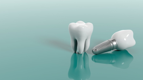 7 Things to Remember while Looking for a Dentist in Kitchener