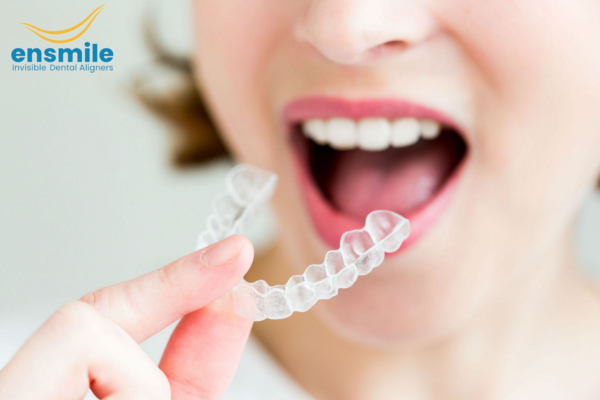 Invisible Aligners for Faster and Effective Dental Healings