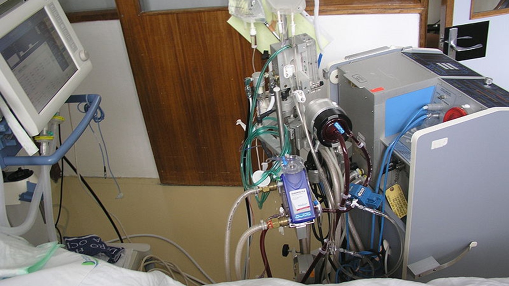 What is ECMO and How it Saved Many Young Lives During Covid-19’s Second Wave?