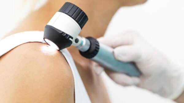 When to visit Skin Cancer Clinic Melbourne
