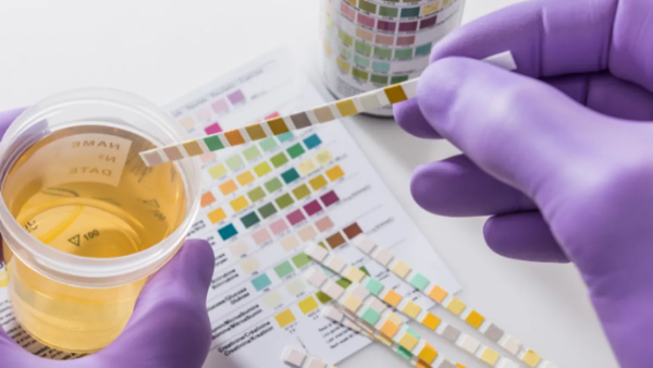 CBD and Drug Tests: How to Pass A Drug Test Even After Taking CBD